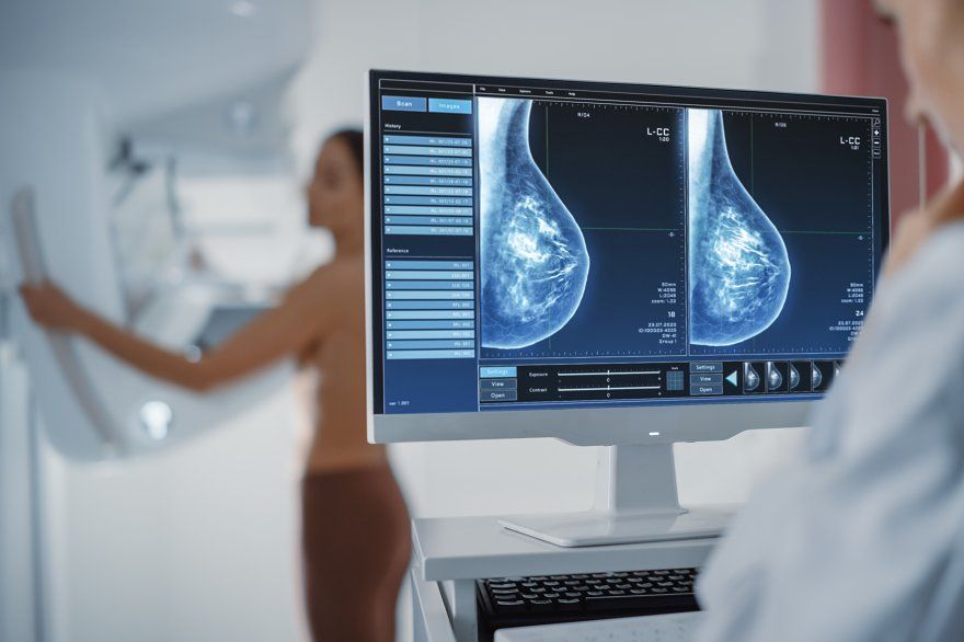Breast Health & Mammography Screening