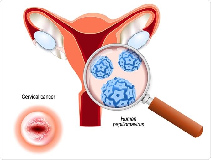 Cervical Health & Cancer Prevention